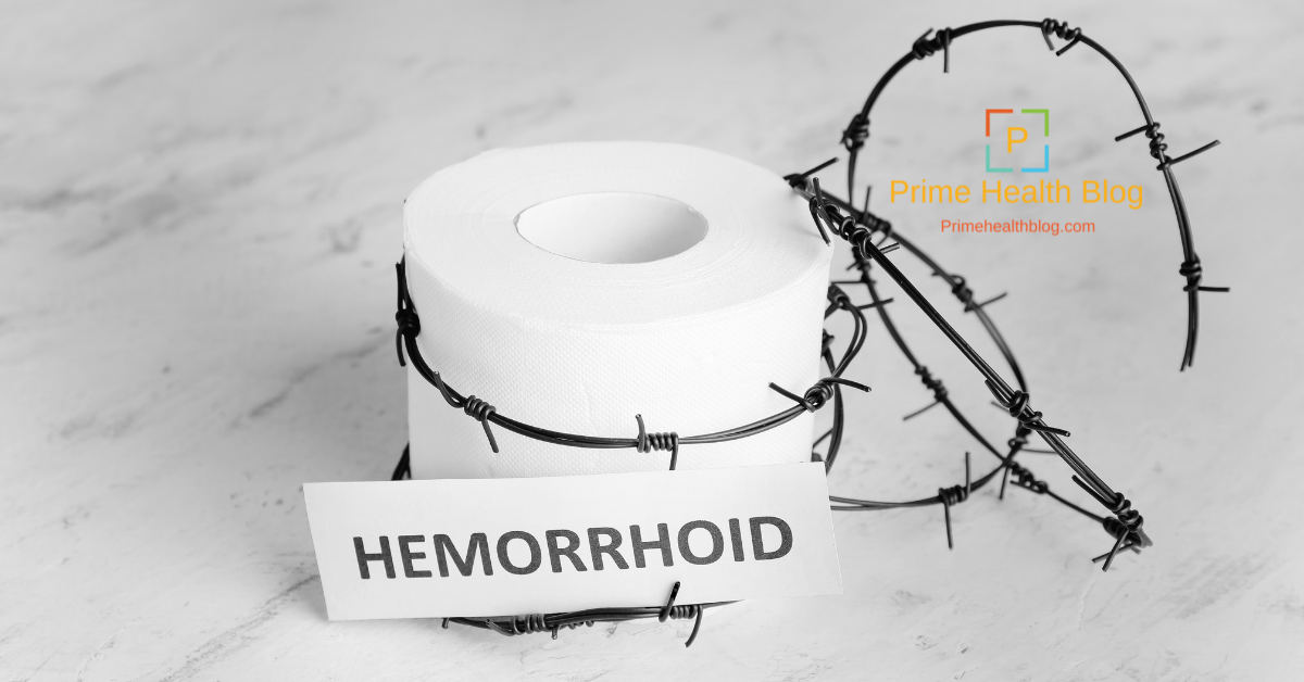 Hemorrhoids What Do They Look Like Archives » Prime Health Blog