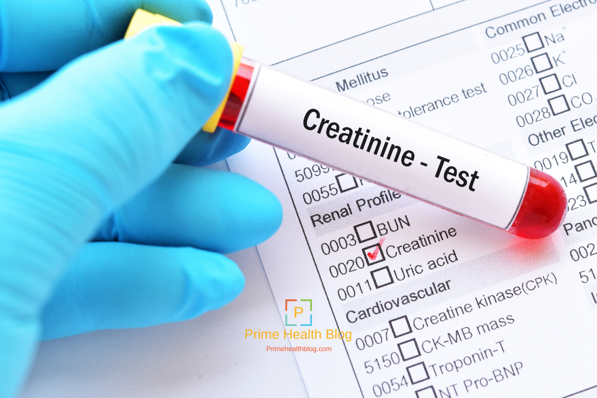 Creatinine Blood Test: Normal, Low, High Levels & Symptoms